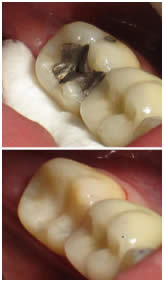 Intraoral photography with the ICON Digi-doc camera at Broadview Dental Clinic